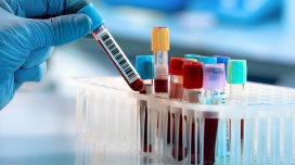 COVID-19 sağ qalanların qanında qeyri-adi dəyişikliklər aşkar edildi