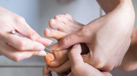 Dırnaq batması problemi nədir?