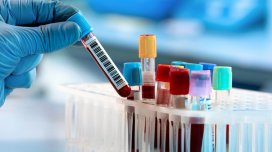 Ağ ciyər xərçəngini tək bir hüceyrə ilə aşkar etmək mümkün oldu