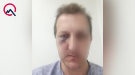 Bakıda Xalq artistinin oğlunu döydülər - Saxlanılan var