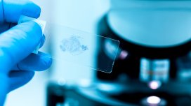 Erkən yaşlanmanın yeni səbəbi aşkarlandı