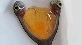 İki baş və bir bədən: Alimlər təsadüfən nadir siam əkizlərini aşkar etdi