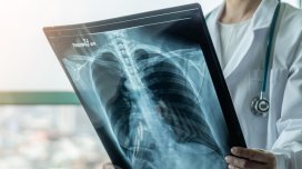 Yaşlılar üçün ağciyər xərçənginin effektiv müalicə metodu açıqlandı