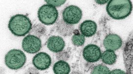 Hantavirus xəstəliyi yayılıb?