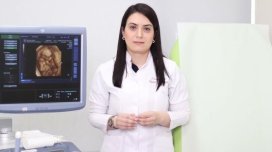 Ginekoloq-həkim Günel Nəcəfovanın otağında oğurluq