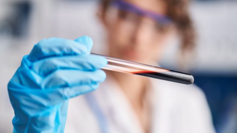 Qan hüceyrələrini "cavanlaşdırmaq" üçün dərman hazırlandı