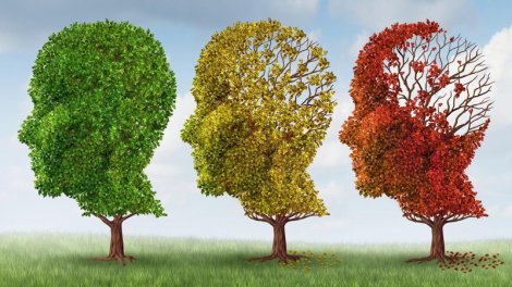 Gənclik anlayışı dəyişir: Alimlər beynin 5 yaş mərhələsini müəyyən edib