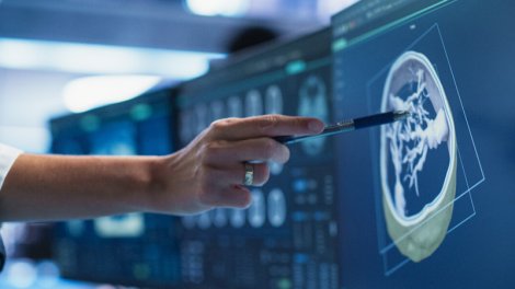 Kimyaterapiyanın təsirini artırmağın gözlənilməz yolu tapıldı