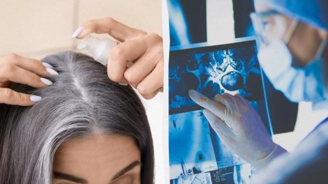 Ağ saçlara görə narahat olmayın: Saçın qocalmasının gözlənilməz funksiyası...