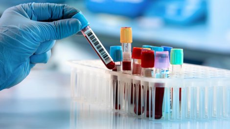 Həkim hər il edilməli olan testləri açıqladı