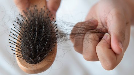 Həkim: "Mövsümi saç tökülməsi 2-3 aydan çox çəkmir"