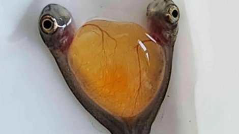 İki baş və bir bədən: Alimlər təsadüfən nadir siam əkizlərini aşkar etdi