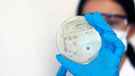 Bağırsaq bakteriyaları beynin zədələnməsi ilə əlaqəli ola bilər