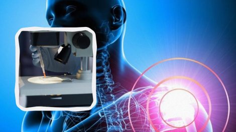 Alman alimlərinin kəşfi osteoporozun inkişafını dayandıra bilər