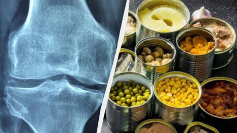 Həkim 50 yaşdan sonra sümükləri möhkəm saxlamağa kömək edən ən yaxşı qidanı açıqladı