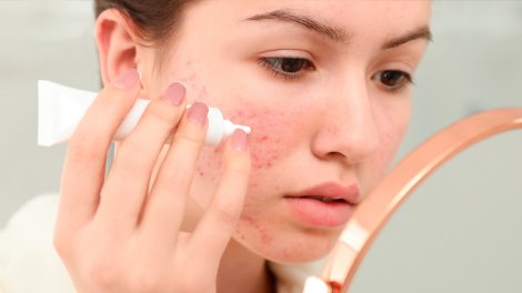 Dermatoloq sağlam dəri üçün lazım olan məhsulları açıqladı