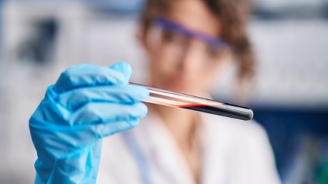 Hantavirus COVID-19 qədər təhlükəlidir? - Alimdən açıqlama