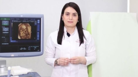 Ginekoloq-həkim Günel Nəcəfovanın otağında oğurluq