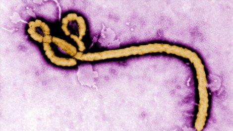 Ebola virusu təhlükəsi böyüyür