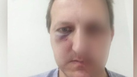 Xalq artistinin oğlunun döyülməsinə görə daha 2 şəxs saxlanıldı

