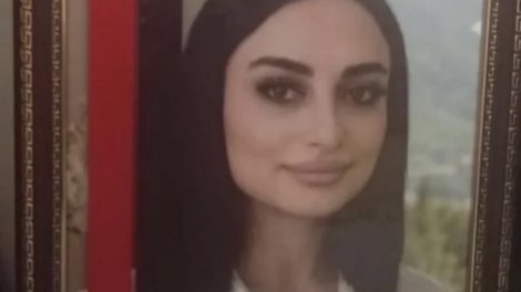 Bakıda rinoplastika əməliyyatından sonra iflic olan 34 yaşlı qadın öldü