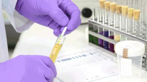 Nikahdan əvvəl cütlüklər narkoloji testdən keçməlidir?