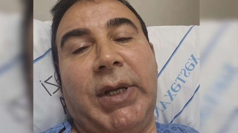 İlham Mirzəyev infarkt keçirib