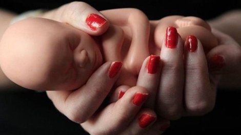 Azərbaycanda abortların sayı niyə yüksəlir?