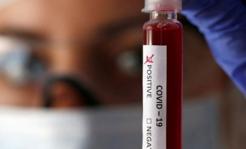 Azərbaycan indiyədək neçə koronavirus testi edib?