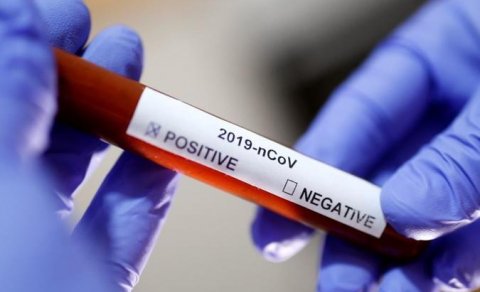 Kişilərin koronavirusa qarşı həssaslığının səbəbi açıqlandı
