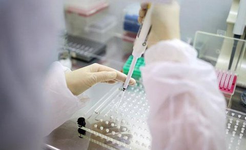 Azərbaycanda koronavirus testlərinin sayı açıqlandı
