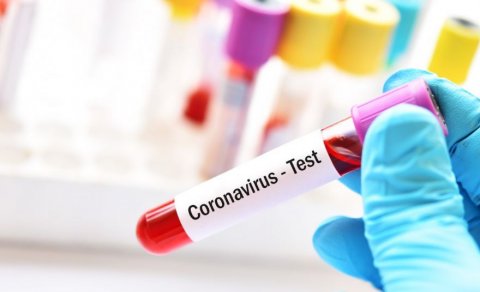 Bunlar da koronavirus əlamətidir?