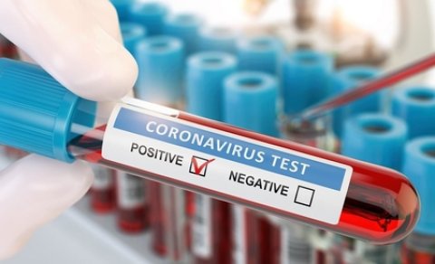 Klinikalar koronavirus testi müayinələrini dayandırdı