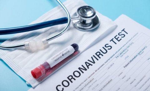 Hər yerdə havayı, Azərbaycanda pulla... – Koronavirus testləriylə bağlı açıqlama