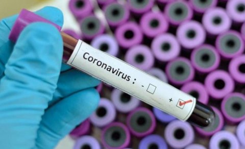 Koronavirus testlərinin qiyməti niyə yüksəkdir? – Deputat açıqladı