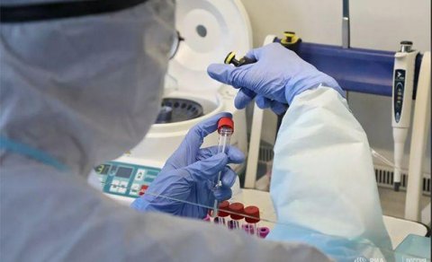 Azərbaycanlı professor koronavirusa qarşı vaksin hazırlayır — VİDEO
