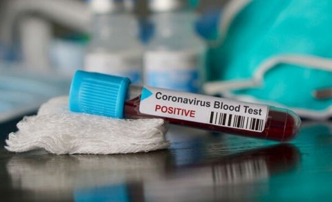 Koronavirusa yoluxanların sayı açıqlandı - GÜNÜN STATİSTİKASI