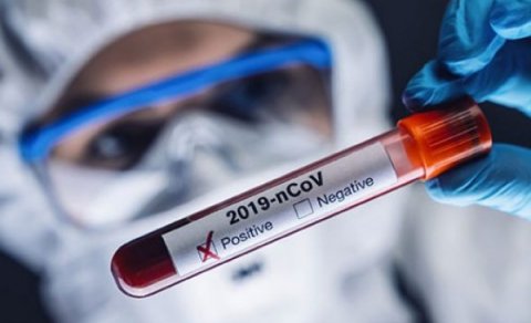 Azərbaycan Rusiyadan koronavirus dərmanı ALA BİLƏR