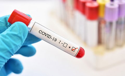 Koronavirusa yoluxanların sayı artdı - GÜNÜN STATİSTİKASI