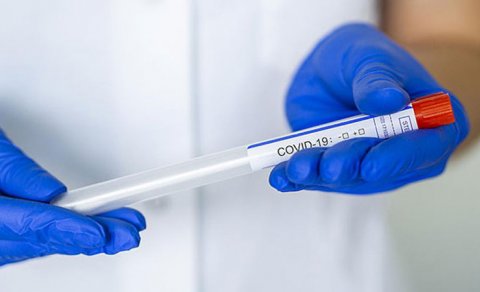Koronavirusa yoluxanların sayı 530-a çatdı - GÜNÜN STATİSTİKASI