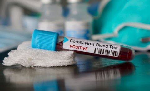 Koronavirusa yoluxma sayında rekord artım - GÜNÜN STATİSTİKASI