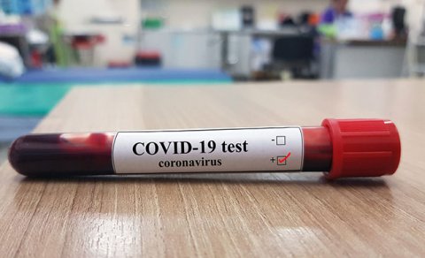 Koronavirusa yoluxanların sayı kəskin azaldı - GÜNÜN STATİSTİKASI