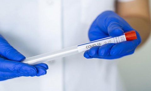 47 yaşlı həkim də koronavirusun qurbanı oldu - FOTO