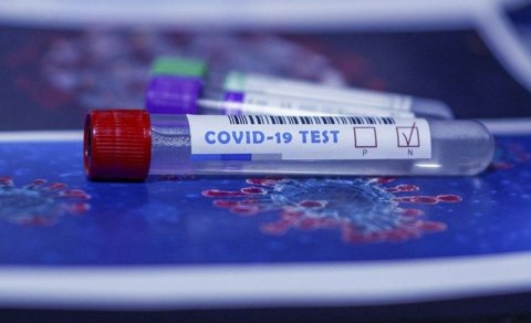 Azərbaycanda indiyədək 2 790 980 koronavirus testi aparılıb