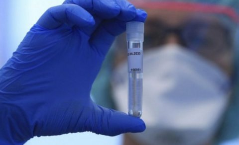 Azərbaycanda daha 32 nəfər koronavirusdan öldü - 2163 yeni yoluxma