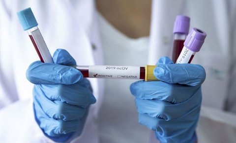Koronaya yoluxanların sayı xeyli azaldı - Günün statistikası
