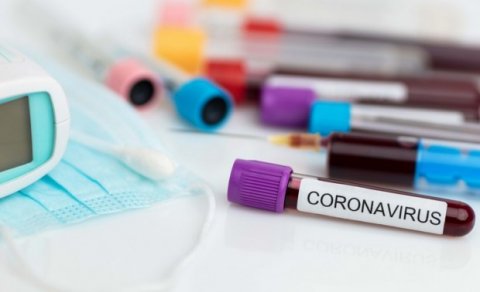 Azərbaycanda daha 472 nəfərdə koronavirus aşkarlandı