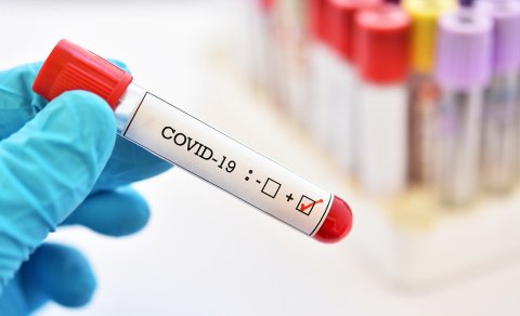 Koronavirusa yoluxanların sayı daha da azaldı - Günün statistikası