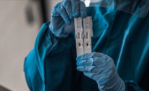 Azərbaycanda koronavirusdan 2 nəfər də öldü - Günün statistikası