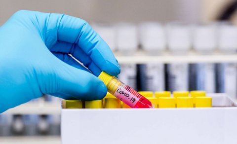 Koronavirusa yeni yoluxanların sayı AÇIQLANDI